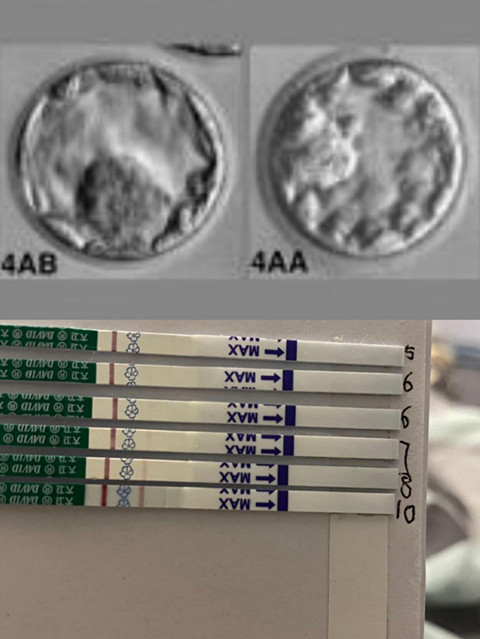 泰国曼谷BIC试管婴儿成功率真的高我试管一次成功（图4）