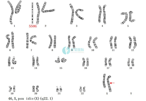 染色体平衡易位可以通过泰国第三代试管婴儿生出健康宝宝吗？（图1）