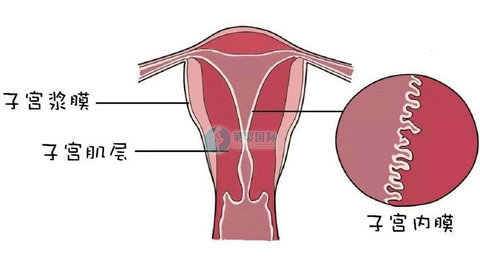 女性子宫输卵管造影要怎么做？