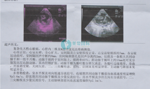 有心脏病能不能做泰国试管婴儿怀孕生宝宝？（图1）