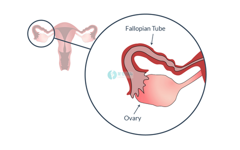 女性卵巢储备功能减退能自然怀孕吗？（图3）