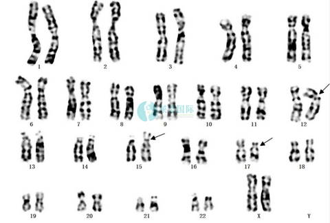 为什么有些胎儿会出现染色体异常的情况？（图1）
