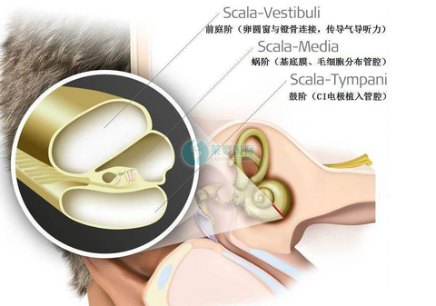 夫妻都有耳聋基因，大女儿先天性耳聋，做泰国试管终于有了个健康的孩子（图1）