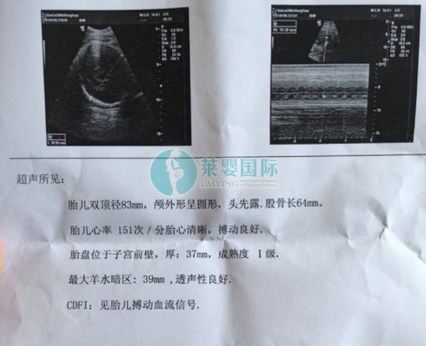 28岁卵巢早衰，中西医看遍借无效果，做泰国试管携子归来（图3）