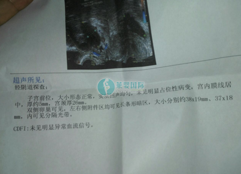 双侧输卵管堵塞，做泰国试管婴儿一次怀上龙凤胎（图1）