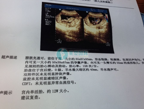 一直监测排卵备孕，却毫无效果，转而做泰国试管婴儿，一次成功！（图3）