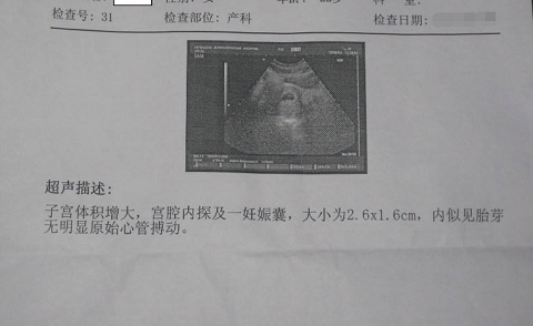 做泰国试管婴儿，老公说我变得玻璃心，其中艰辛只有自己知道（图2）