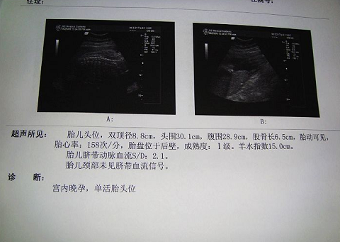 泰国试管婴儿成功好孕啦，和大家说说你们最关心的一些问题（图2）