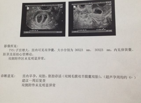 28岁来泰国做试管，说说我在泰国都干了些啥（图1）