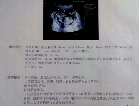 宝宝16周啦，刚做完产检回来，给大家分享下我去泰国做试管婴儿的事情（图1）