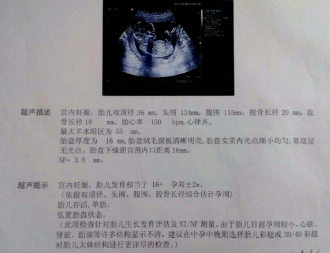 40岁生二胎，自然怀孕无果，感谢泰国试管婴儿圆了我的儿女双全梦