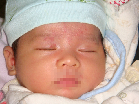 多囊卵巢导致不孕，做泰国试管婴儿生男孩（图3）