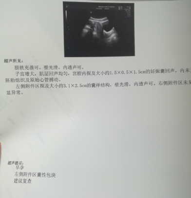 老公精子质量差，自然怀孕胎停，做泰国试管婴儿让我成功好孕!（图3）