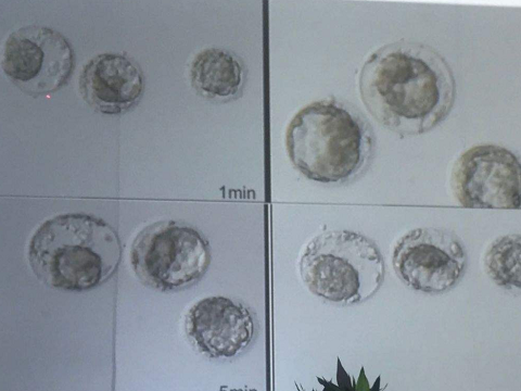 分享35岁卵巢早衰，做泰国试管婴儿成功生男孩经历(图2)