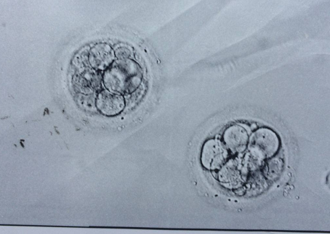 结婚五年没怀孕差点被离婚，多亏泰国试管婴儿成功助好孕!（图3）