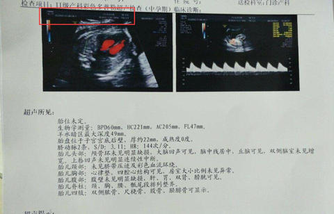 备孕两年没结果，经历了3次试管，在泰国怀上了我的宝宝(图1)