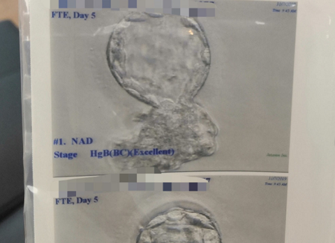 泰国试管移植成功后最明显的感觉有哪些?