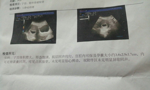 婆婆因为我不能生育，撺掇老公离婚，去泰国做三代试管婴儿成功怀上儿子(图1)