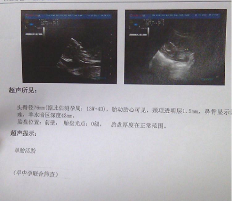 高龄夫妻生二胎，去泰国BNH医院做试管婴儿成功怀上鼠宝宝(图3)