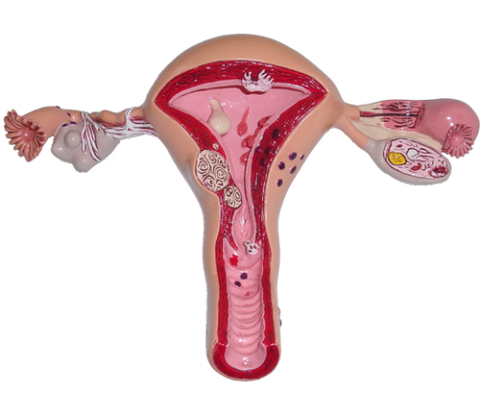 子宫内膜结核，已经停止治疗能做试管婴儿吗(图1)