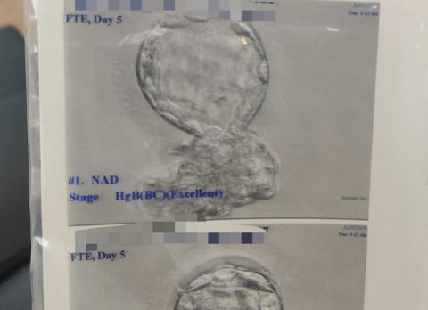 泰国试管胚胎p23和p5筛查，到底哪一个更好?(图3)