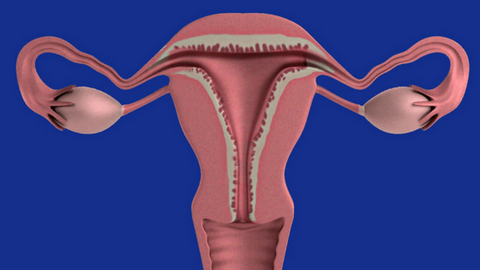 做泰国试管婴儿时，子宫内膜薄对胎停的影响(图3)