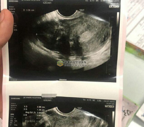 结婚五年不孕，为生子几度欲离婚，说说我的泰国试管之路(一)