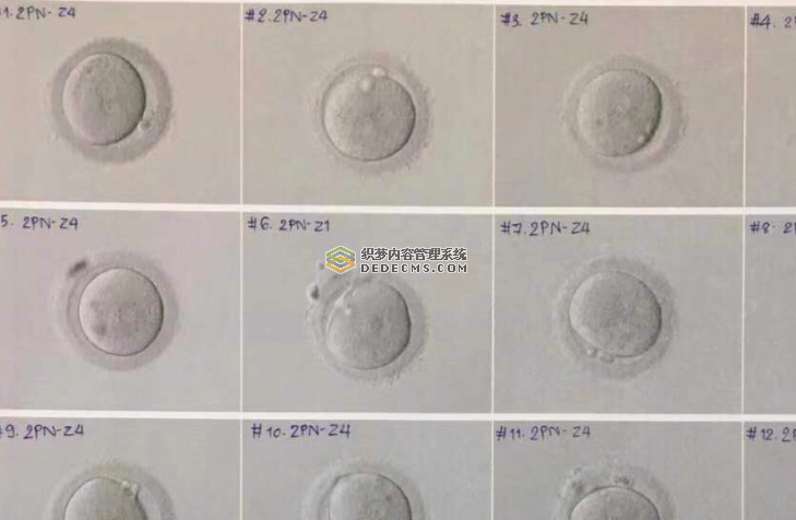 双侧输卵管严重堵塞，在泰国做试管婴儿的记录