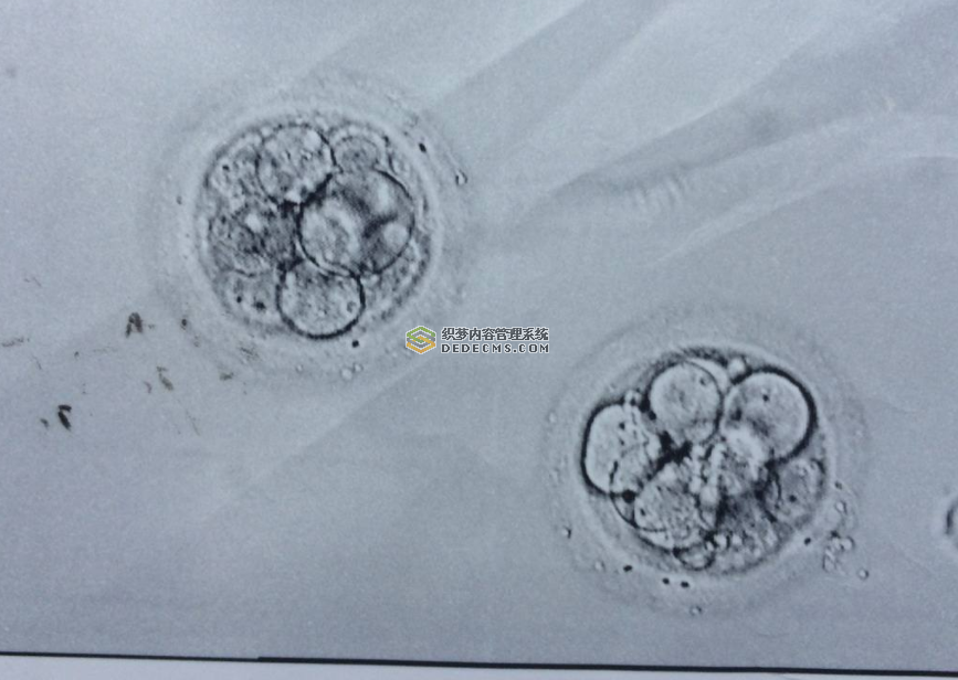 34岁二婚家庭，赴泰国试管婴儿医院选性别生儿子