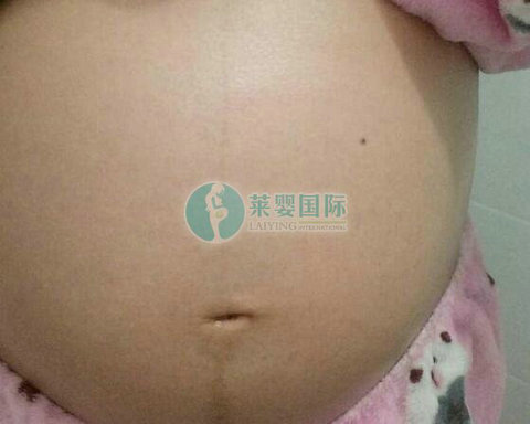输卵管堵塞不孕做泰国试管婴儿好孕(图1)