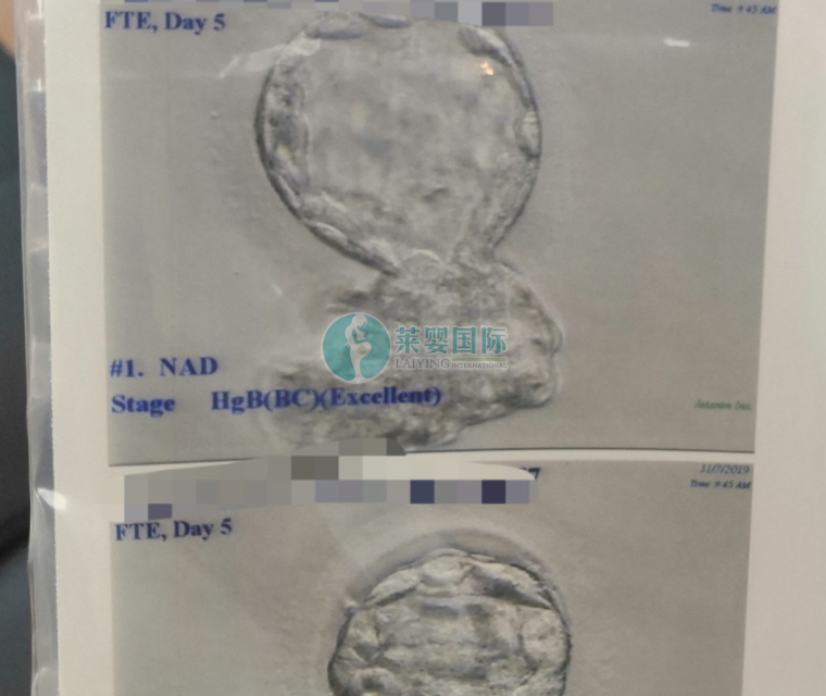 疫情期间不能出国分享我在国内做第三代试管婴儿的经历