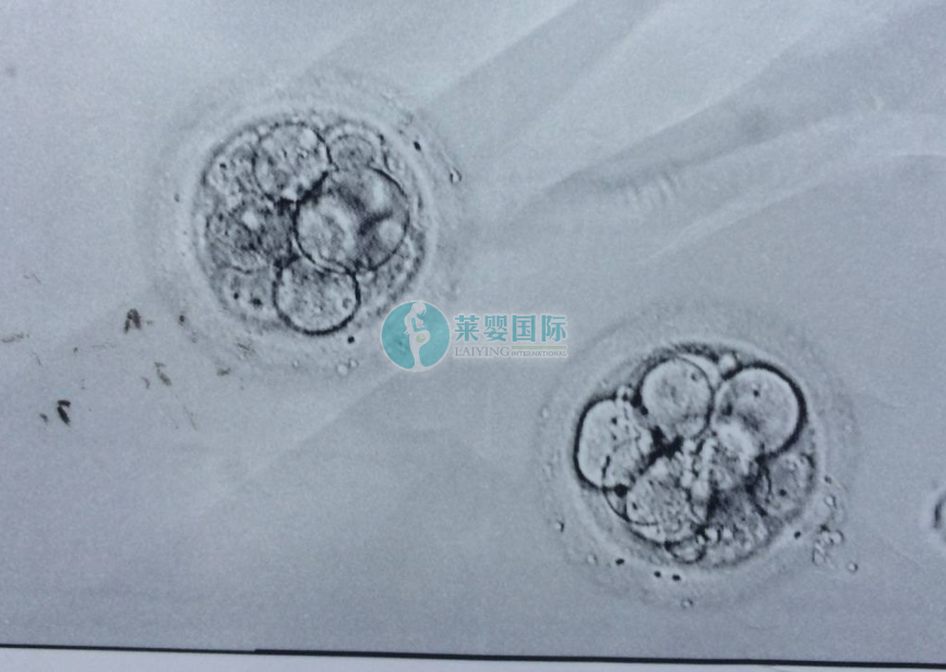 41岁拼二胎做试管婴儿科学调理卵巢功能的经验分享（图2）
