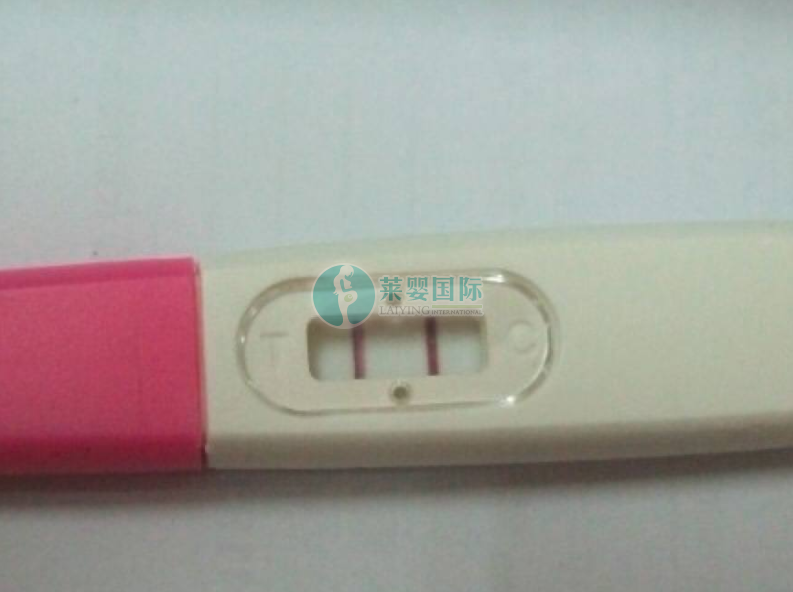 宫外孕切除输卵管，国内试管婴儿验孕成功