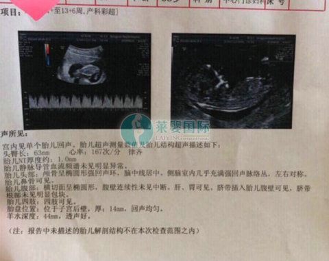 怀孕38周准妈妈分享泰国三代试管婴儿移植后注意事项!