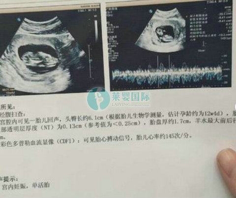 卵巢早衰遇上输卵管粘连，深圳三代试管婴儿成功生男孩