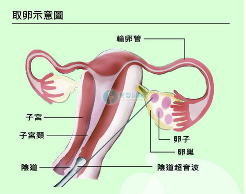 三代试管小知识分享，子宫内膜容受性分析(ERA)是什么?