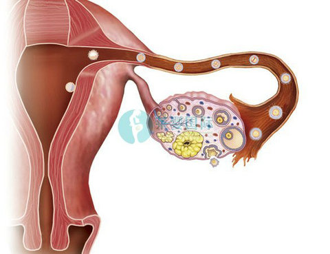 输卵管粘连能做试管婴儿吗?会有哪些风险?