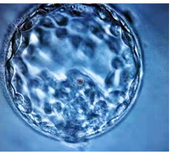 4AA级别的胚胎.jpg