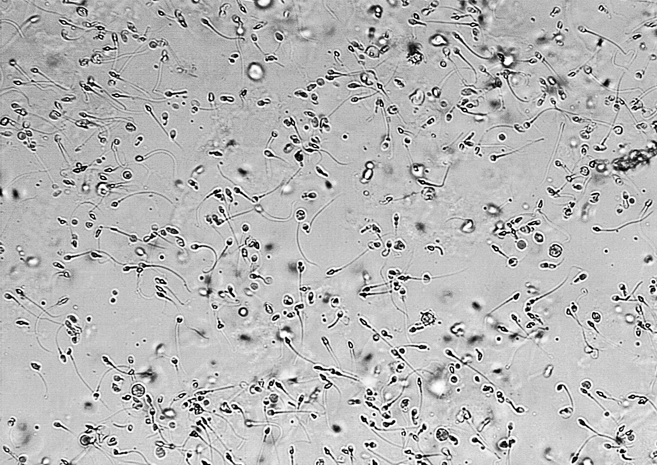 人体染色体显微镜图图片