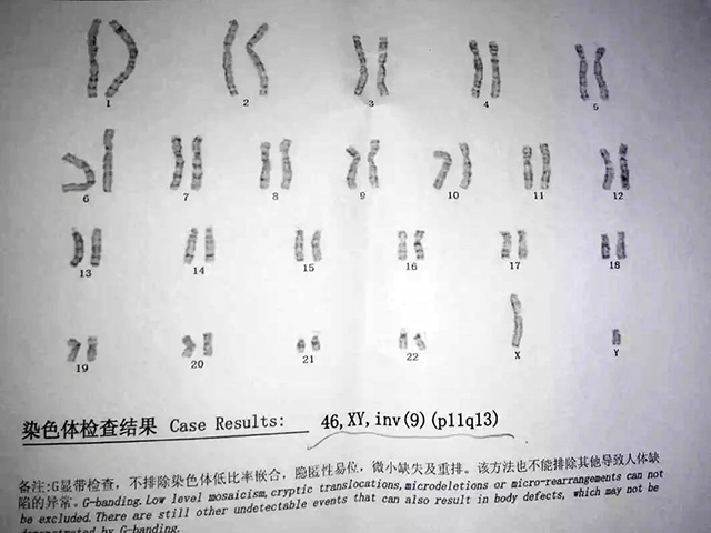 染色体检查报告.jpg