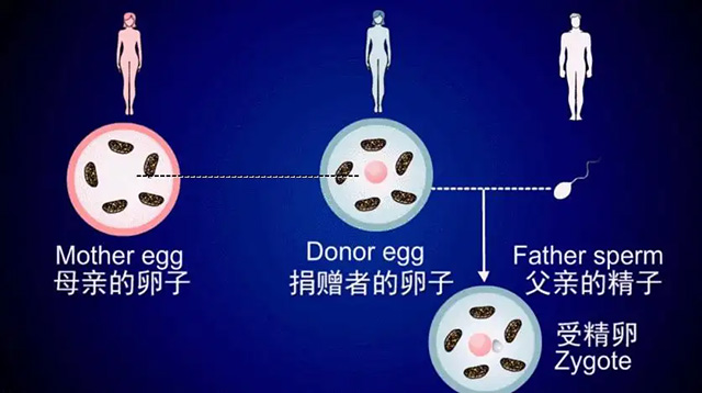 泰国第四代试管婴儿技术(三亲试管婴儿、卵子干细胞试管婴儿技术)