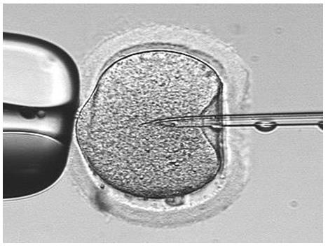 二代试管婴儿可以挑选Y精子