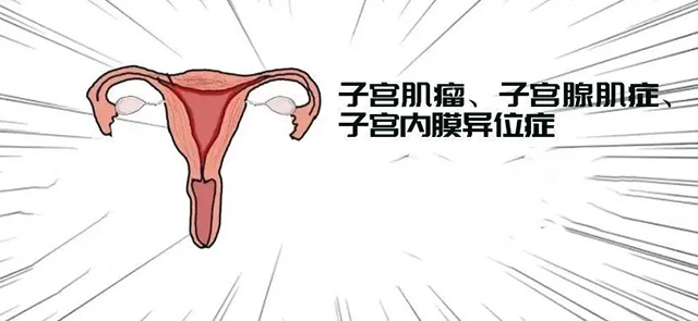 子宫腺肌症可以去泰国做试管婴儿吗