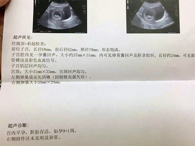 私人医院做试管选男孩的试管经历给姐妹们分享