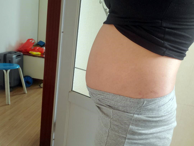 宫腹腔镜后为了快速怀孕我去泰国做试管婴儿（图1）