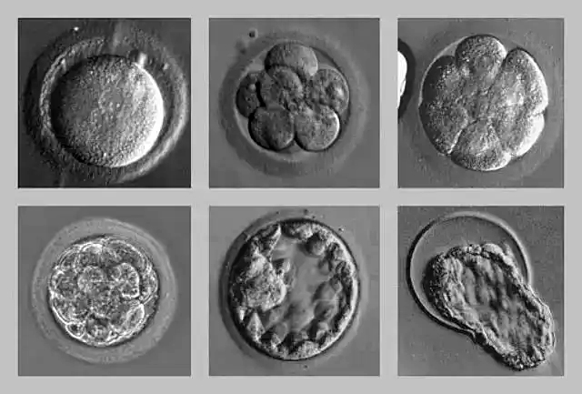 胚胎1.jpg
