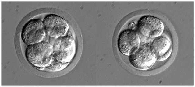 胚胎2.jpg