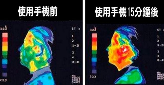 手机辐射会导致男性不孕不育吗？