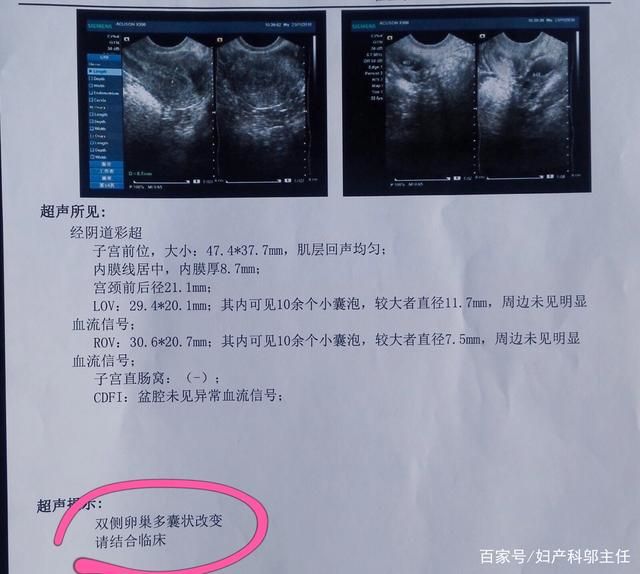 如何提前预防卵巢早衰来提高泰国试管婴儿成功率呢？