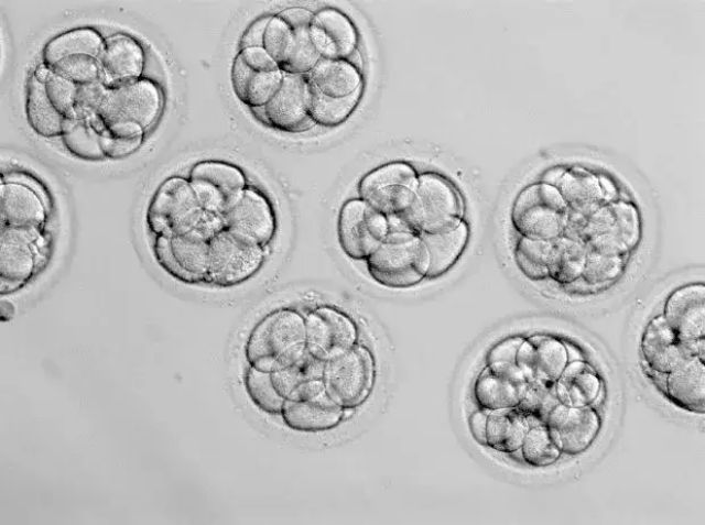 泰国试管婴儿移植2个囊胚，为什么有3个孕囊？（图1）